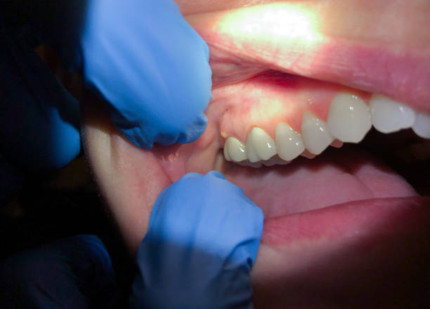 Professional Emergency Dentist in MT