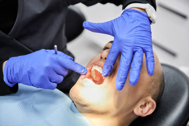 Best Emergency Root Canal Treatment in Manhattan, MT