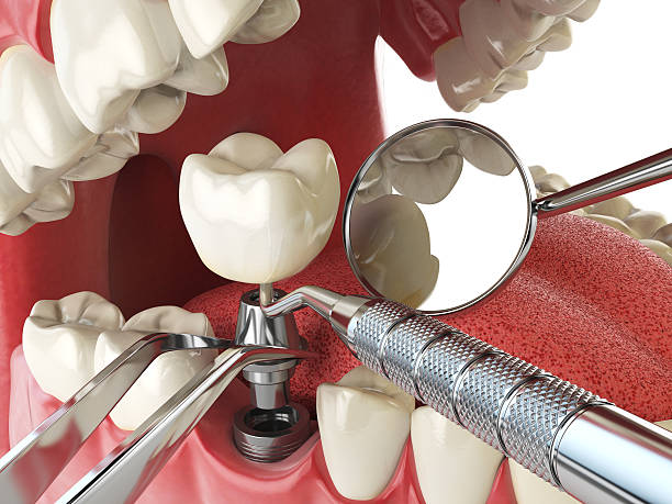 Best Emergency TMJ Treatment in Manhattan, MT